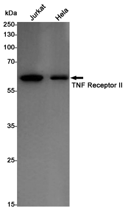Rabbit Monoclonal Antibody to TNF Receptor 2 