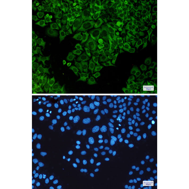Rabbit Monoclonal Antibody to TNF Receptor 2 