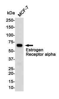 Estrogen Receptor alpha
