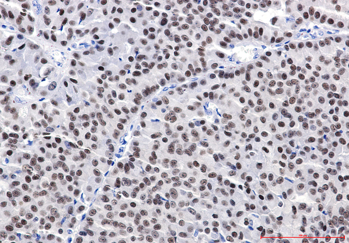 Rabbit Monoclonal Antibody to ER alpha 