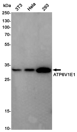 ATP6V1E1
