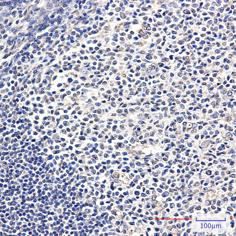 Rabbit Monoclonal Antibody to ATP6V1E1 