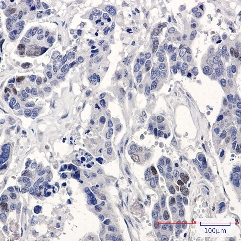 Rabbit Monoclonal Antibody to p21 