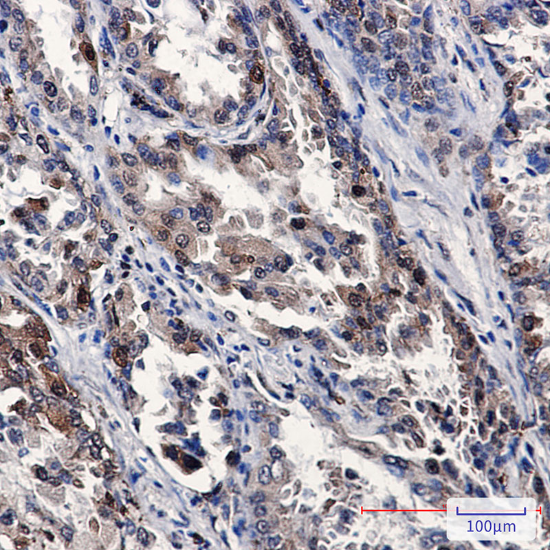 Rabbit Monoclonal Antibody to Stathmin 1 