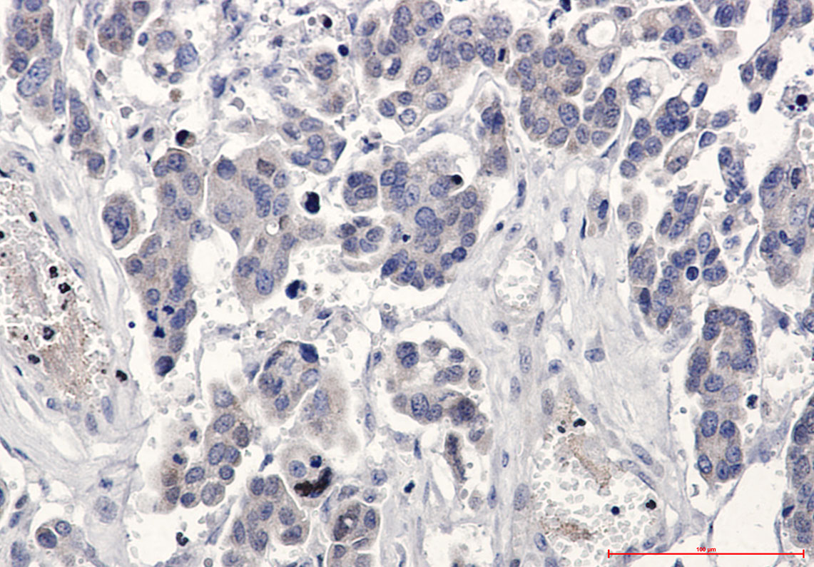 Rabbit Monoclonal Antibody to Bcl-XL 