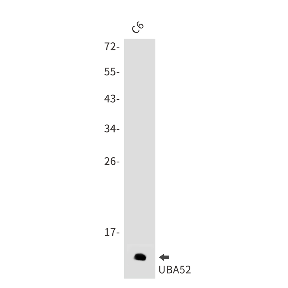 Ubiquitin 60S Ribosomal Protein L40