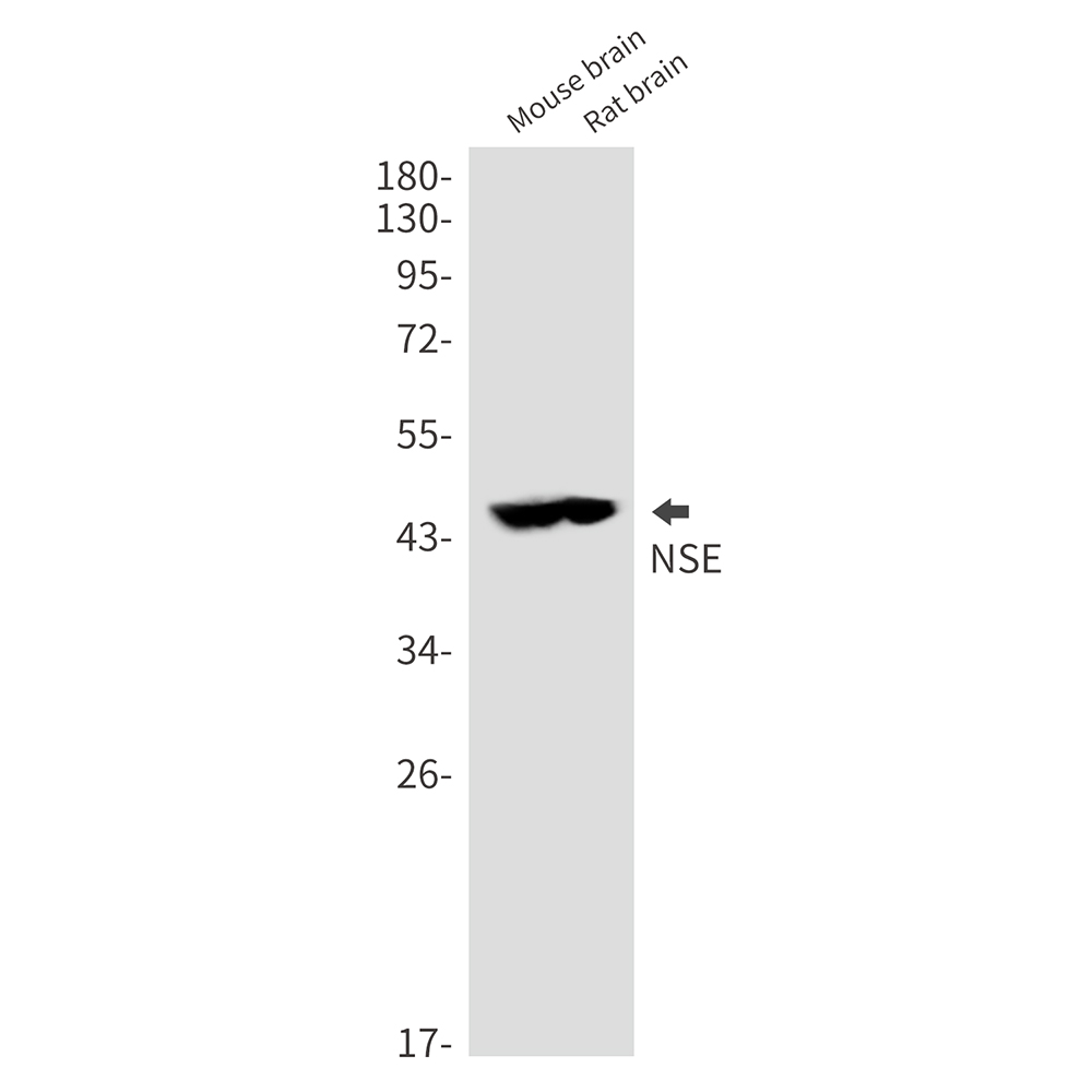 NSE