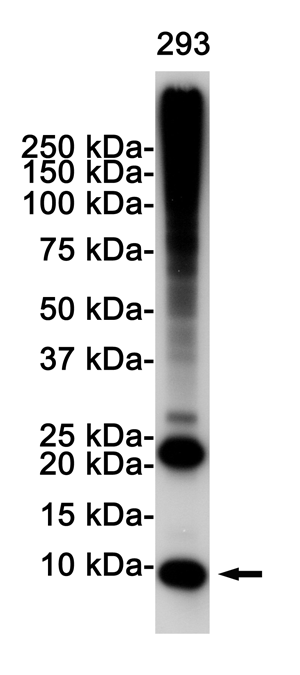 Ubiquitin