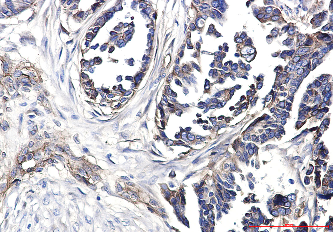 Integrin beta 1