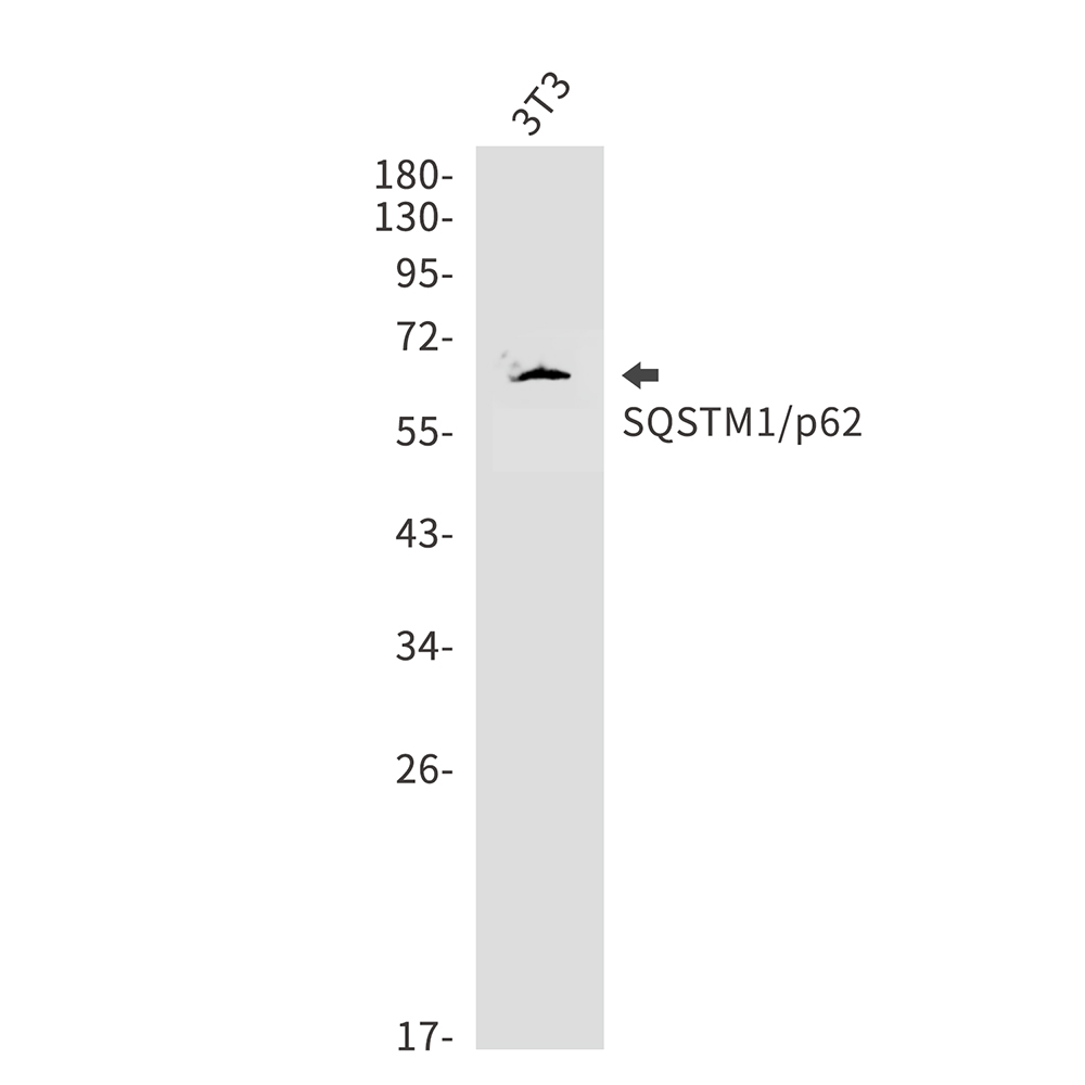 SQSTM1/p62