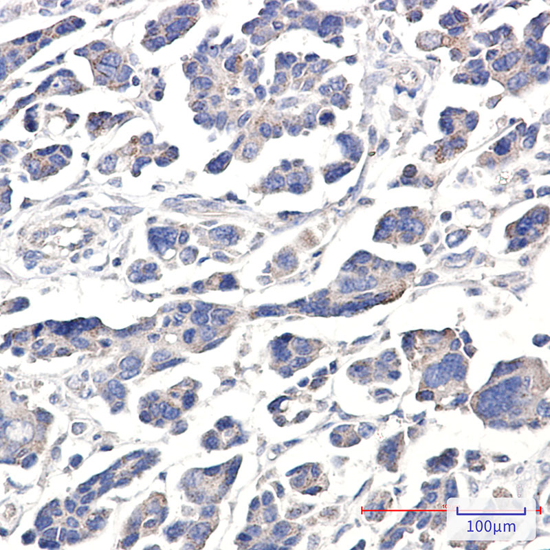 Rabbit Polyclonal Antibody to APG5L