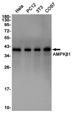 AMPK beta 1