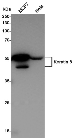 Cytokeratin 8