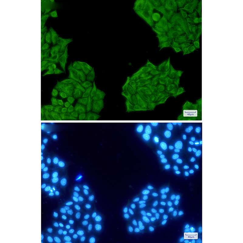 Rabbit Polyclonal Antibody to Cytokeratin 8