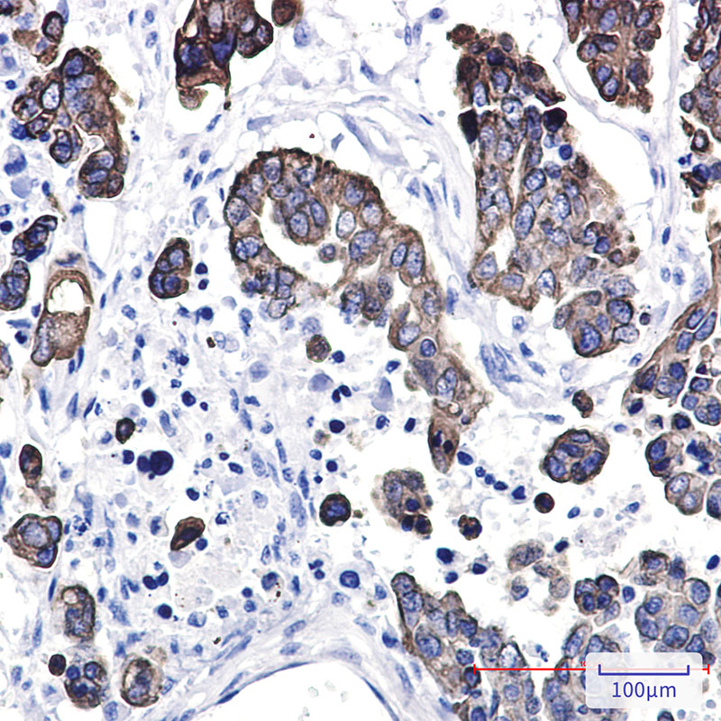 Rabbit Polyclonal Antibody to Cytokeratin 8