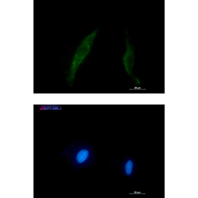 Rabbit Polyclonal Antibody to Smad2/3