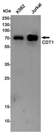 CDT1