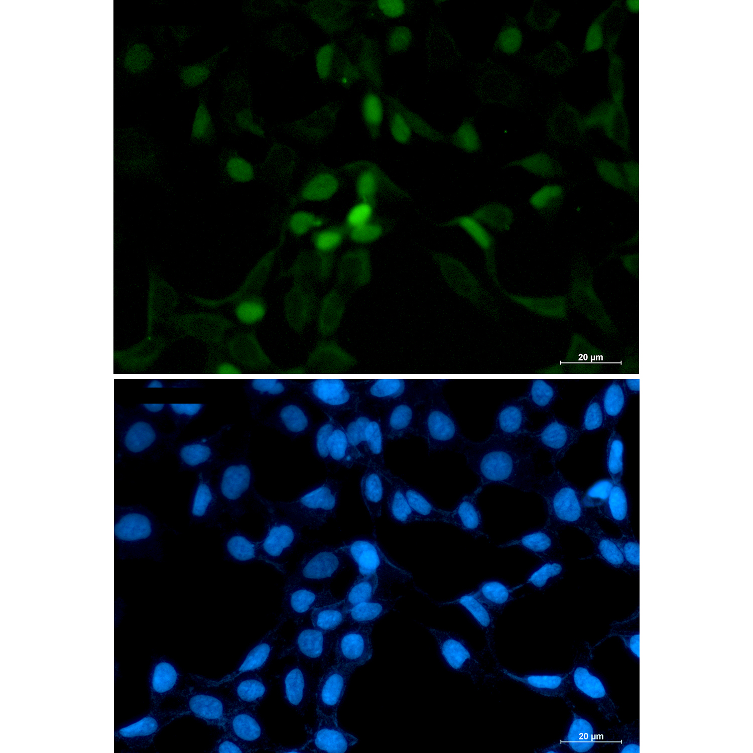 Rabbit Polyclonal Antibody to CDT1