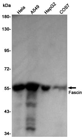 Rabbit Polyclonal Antibody to Fascin
