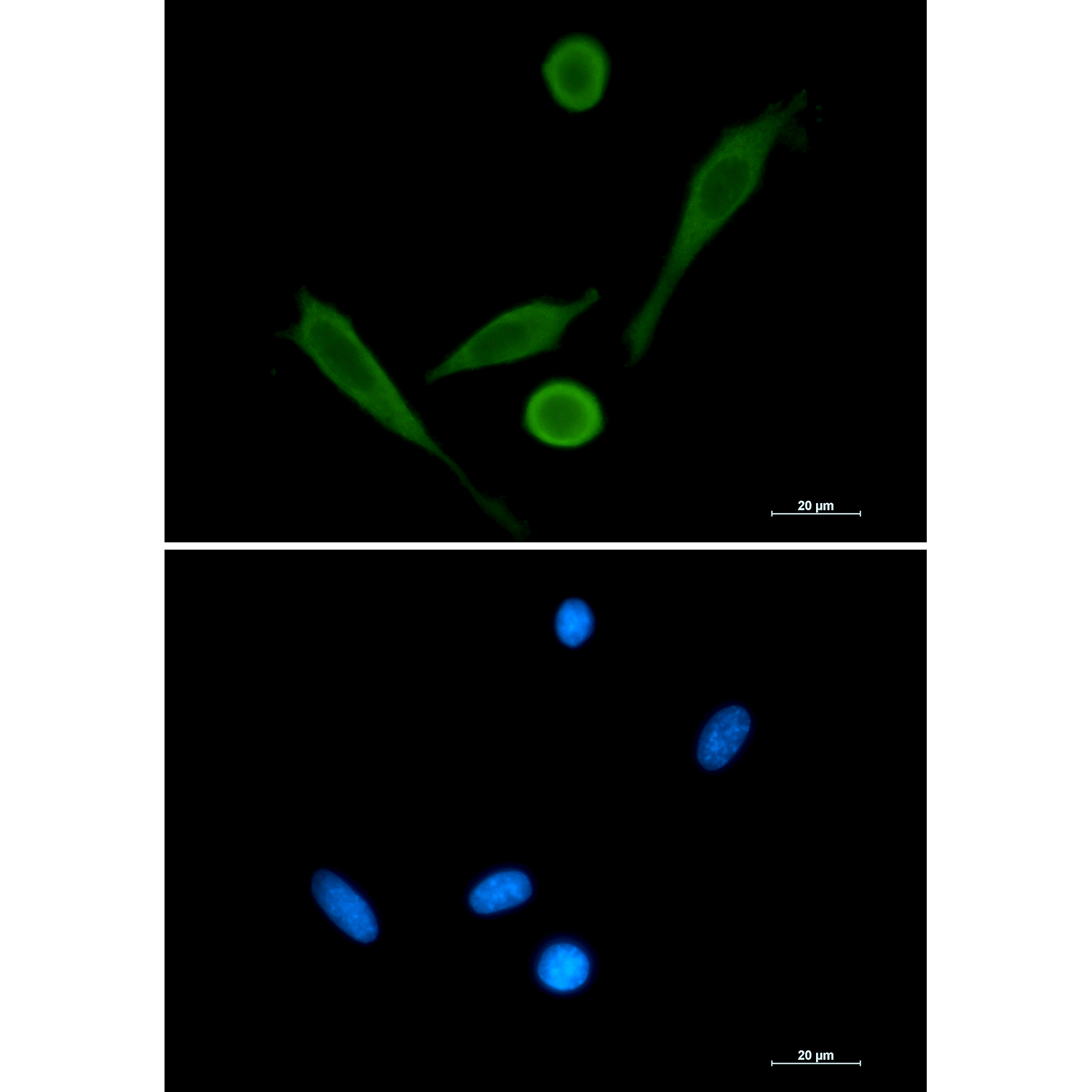 Rabbit Polyclonal Antibody to Fascin