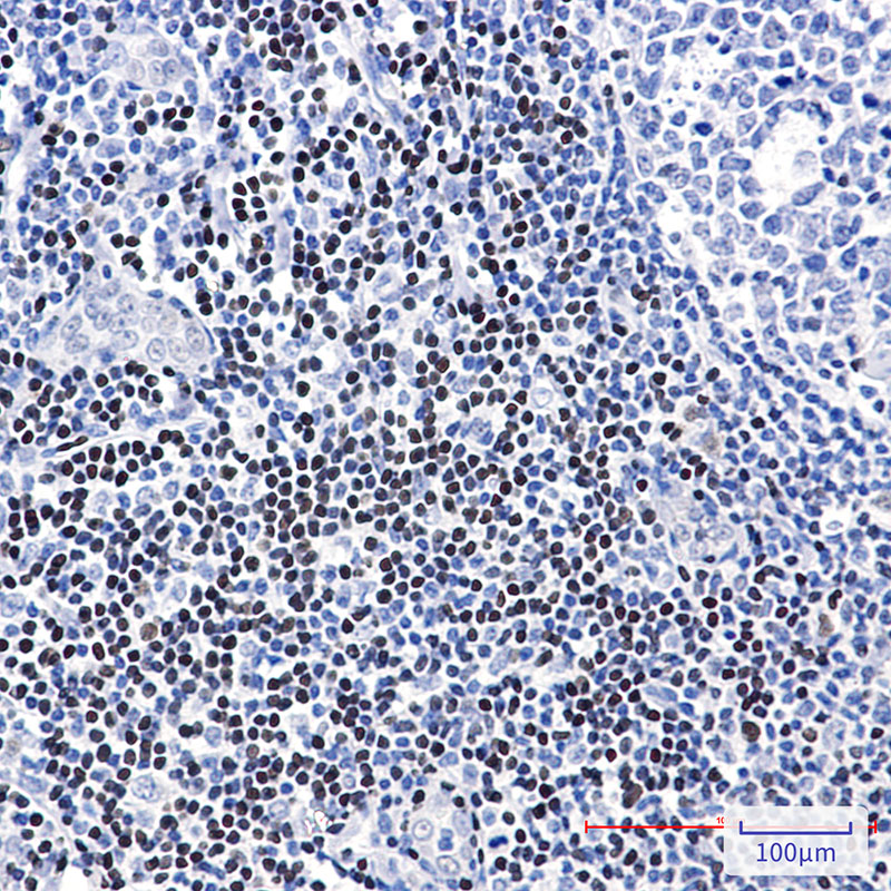 Rabbit Polyclonal Antibody to LEF1