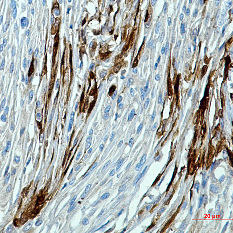 Rabbit Polyclonal Antibody to Calbindin