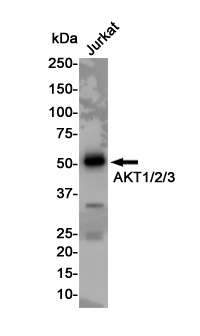 Rabbit Monoclonal Antibody to AKT 