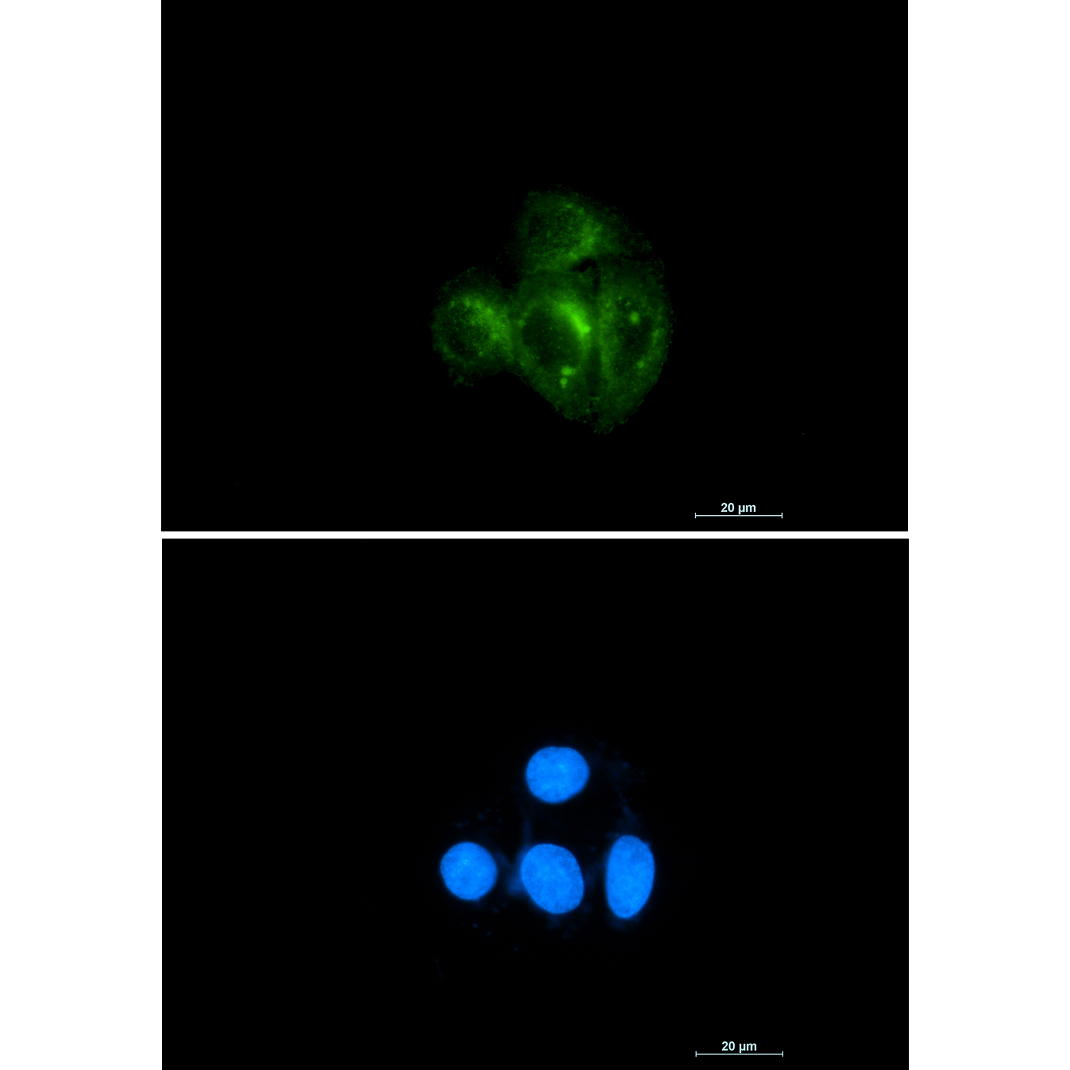 Rabbit Monoclonal Antibody to AKT 