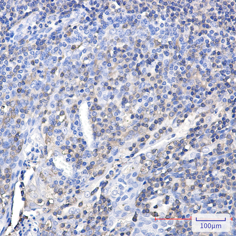 Rabbit Monoclonal Antibody to Plastin L 