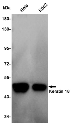 Cytokeratin 18