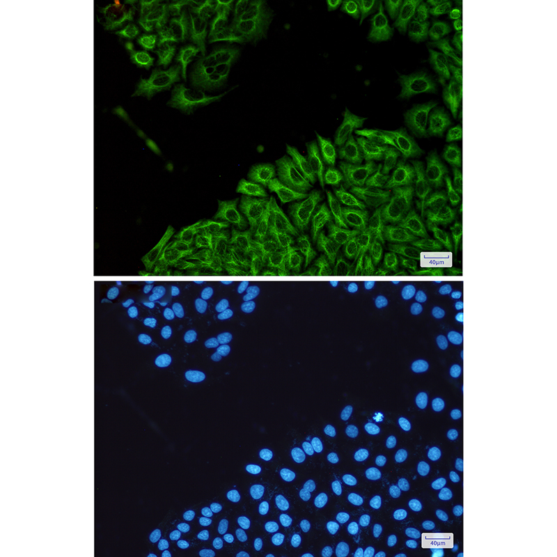 Rabbit Monoclonal Antibody to CK18 