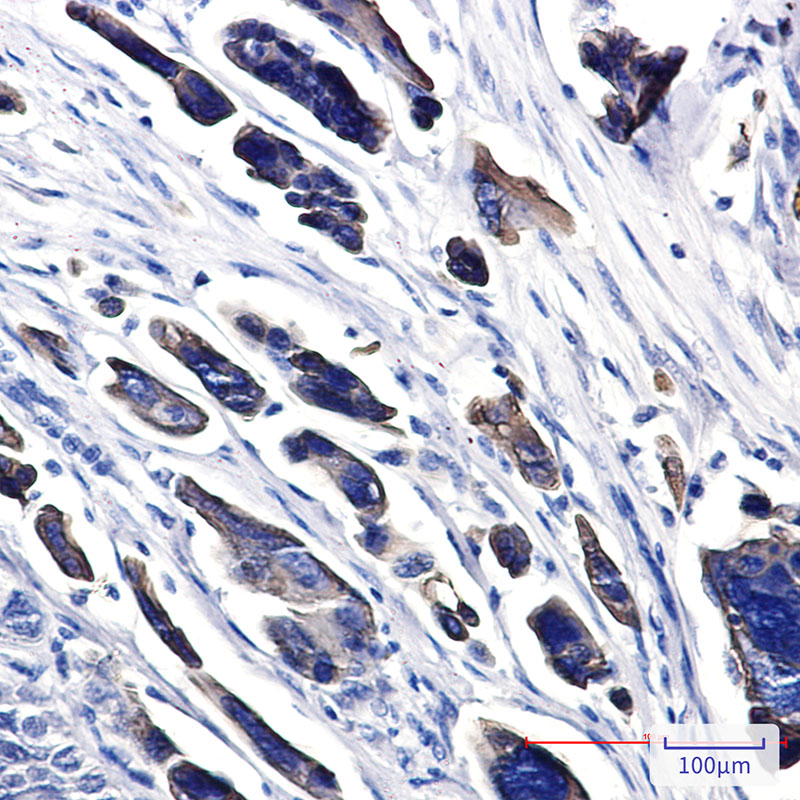 Rabbit Monoclonal Antibody to CK18 