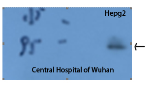 Rabbit Polyclonal Antibody to STAT3