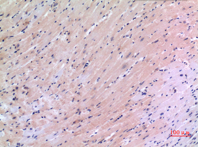 Rabbit Polyclonal Antibody to VEGFC