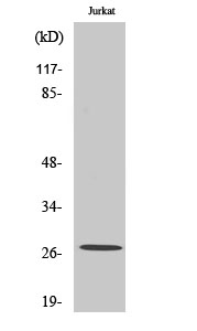 Rabbit Polyclonal Antibody to NGF