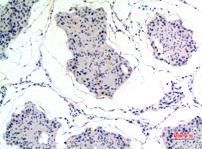 Rabbit Polyclonal Antibody to Thrombospondin 2
