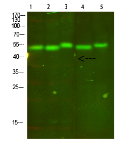 Cytochrome B
