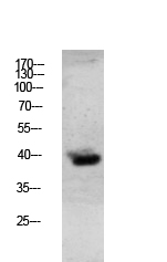 Granzyme B