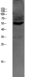 OAT1
