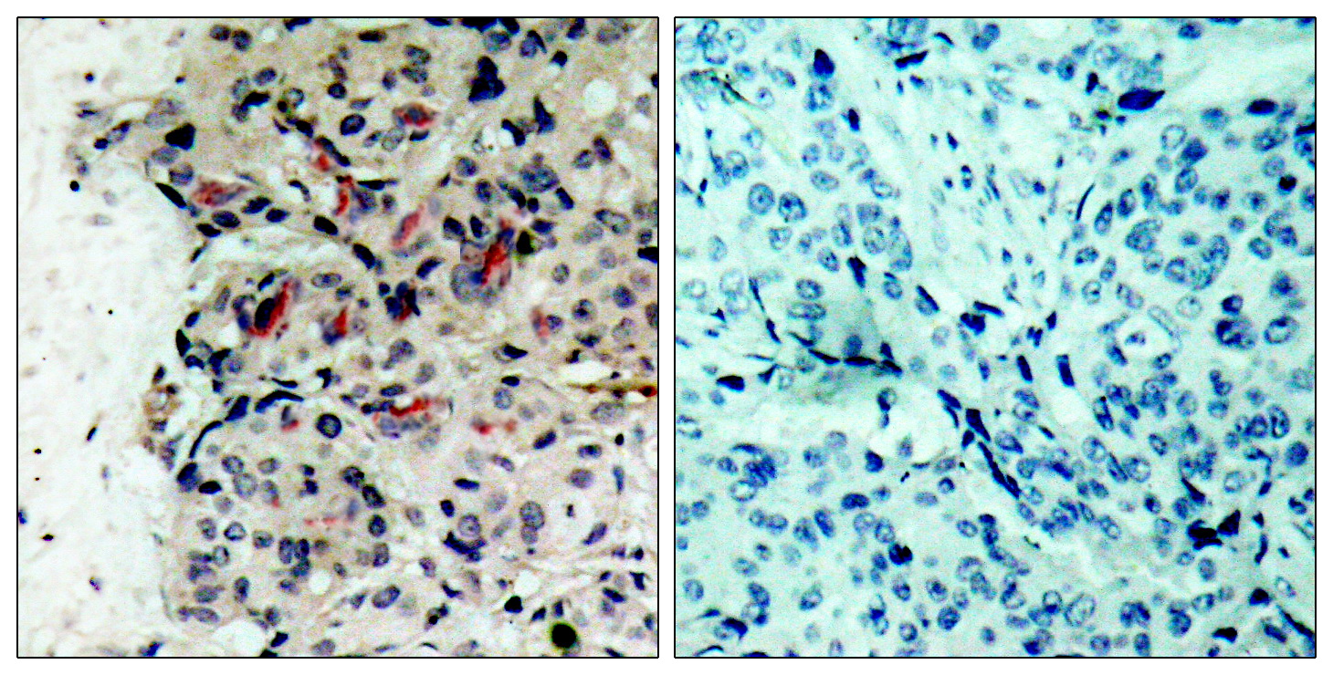 Rabbit Polyclonal Antibody to JAK1