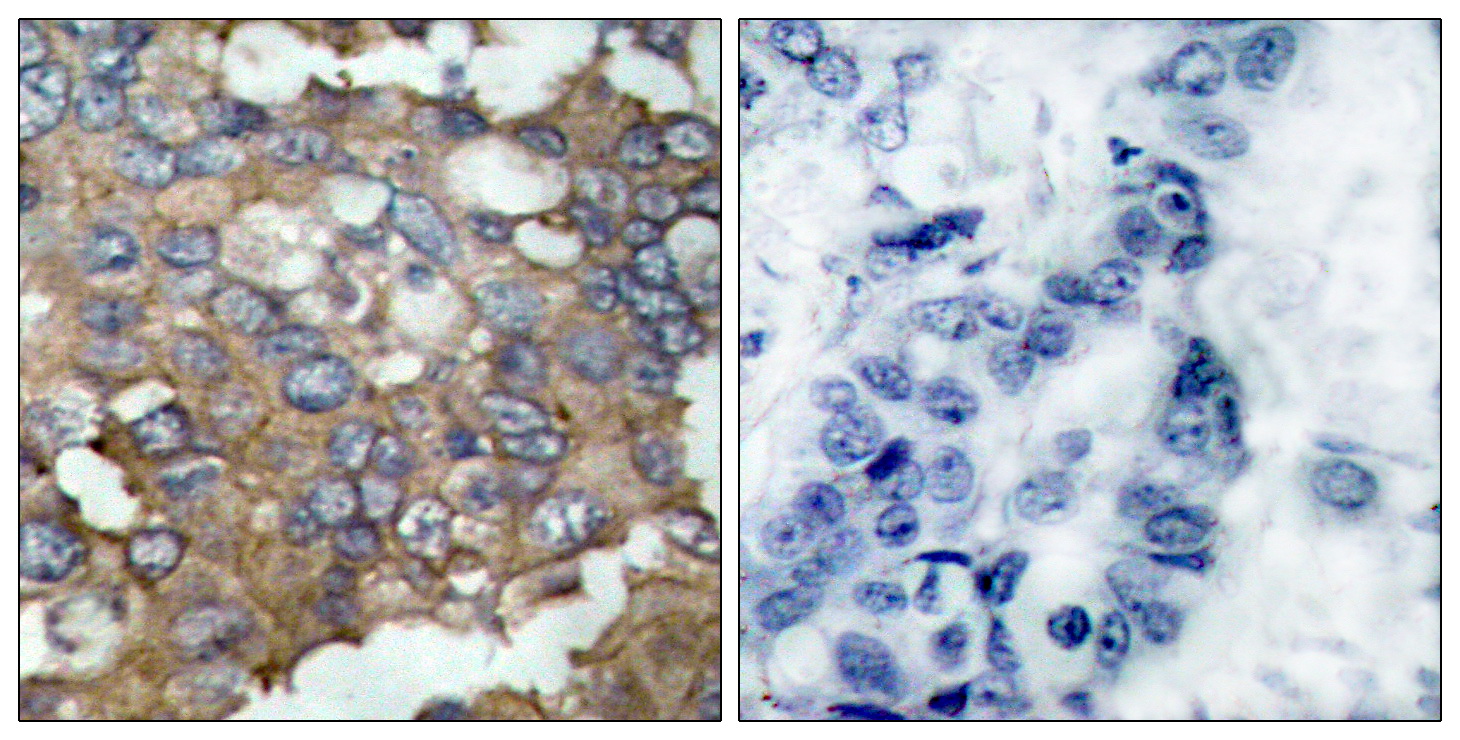 Rabbit Polyclonal Antibody to Src