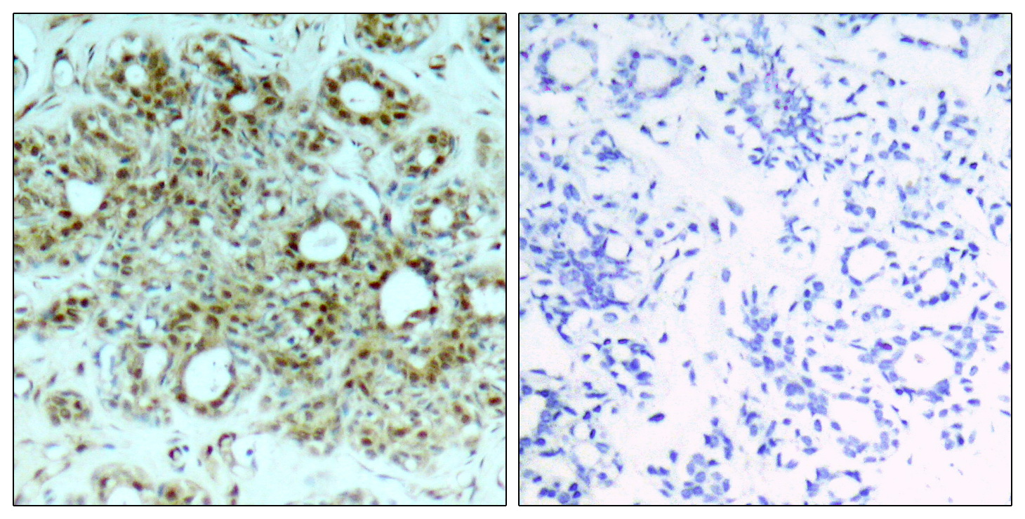 Rabbit Polyclonal Antibody to NF-KB p65