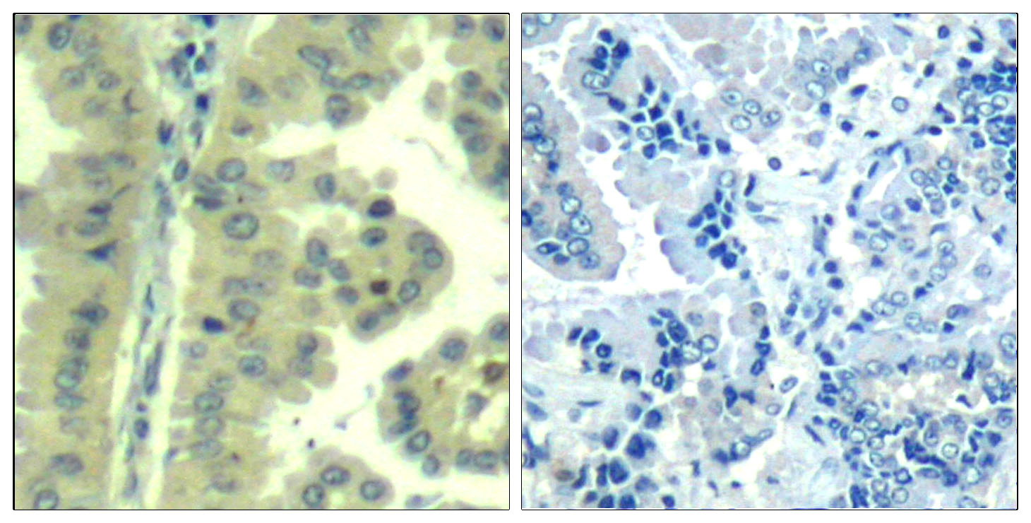 Rabbit Polyclonal Antibody to eIF4G1