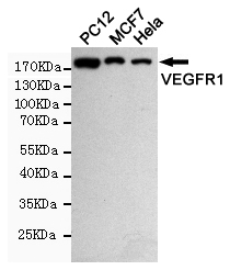 VEGF Receptor 1