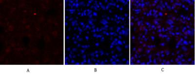 Rabbit Polyclonal Antibody to DRP1
