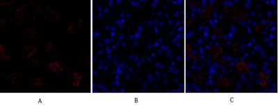Rabbit Polyclonal Antibody to DRP1