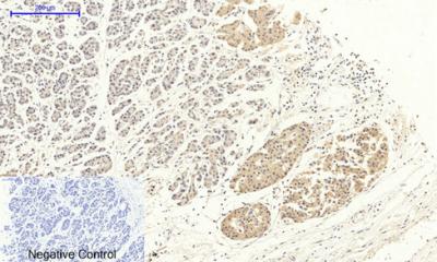 Rabbit Polyclonal Antibody to DRP1