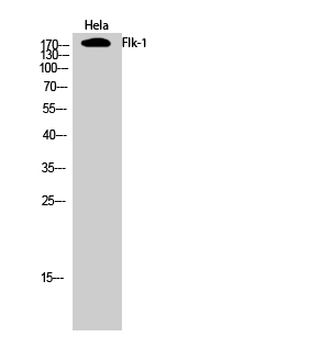 VEGF Receptor 2
