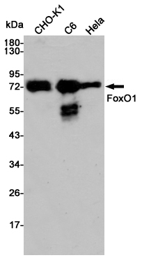 FOXO1