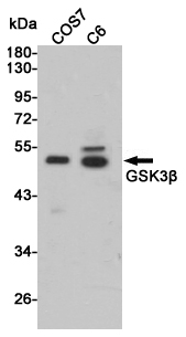 GSK3 beta